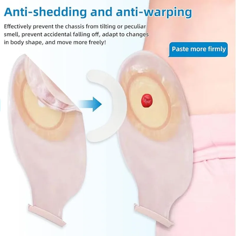 Medical Ostomy Bag Reinforceme - Medical Tape recension och pris